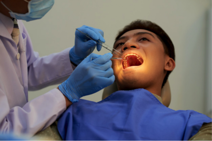 ¿EN QUÉ CONSISTE UN EMPASTE DENTAL?